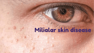 Milialar skin disease